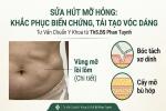 sua hut mo hong